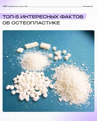 Остеопластика: 5 фактов, которые вас удивят.